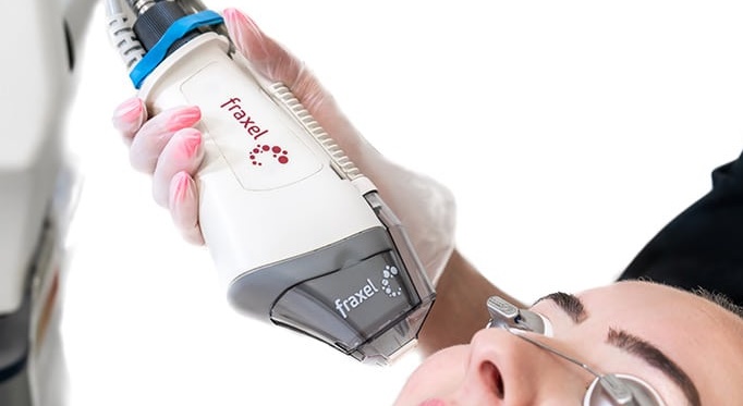 Fraxel fractional laser skin resurfacing acne scar wrinkle Seoul Korea Gangnam